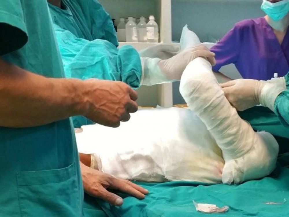 Propunerea CNAS care dă o șansă în plus pacienților cu arsuri - Ce servicii importante vor putea fi decontate de Casă